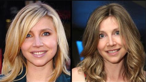 sarah chalke plastic surgery|Sarah Chalke .